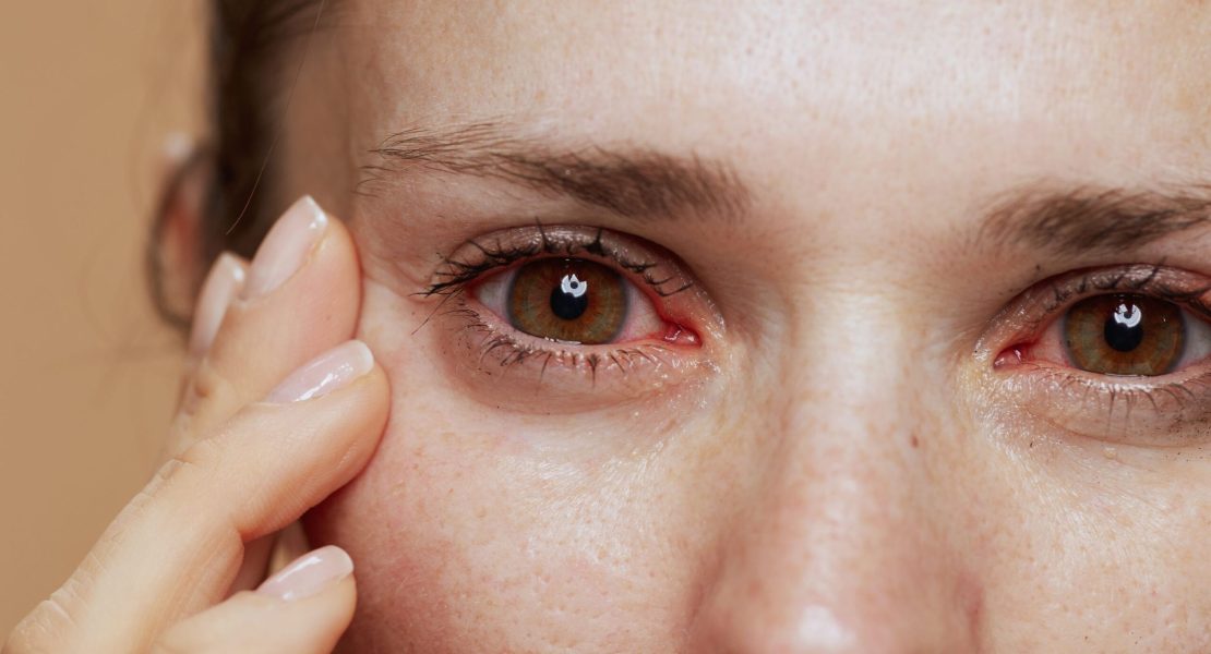 Sequedad ocular